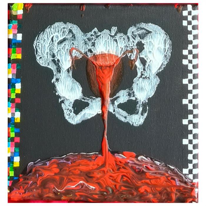 In Utero